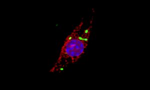 Microscopic image showing a macrophage that has been infected with Salmonella (green), causing cellular cathepsins (red) to locate to the nucels (blue).