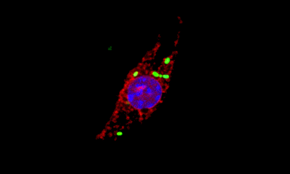 Microscopic image showing a macrophage that has been infected with Salmonella (green), causing cellular cathepsins (red) to locate to the nucels (blue).