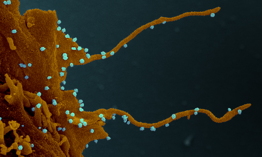 SARS-CoV-2 viruses visible on proteins