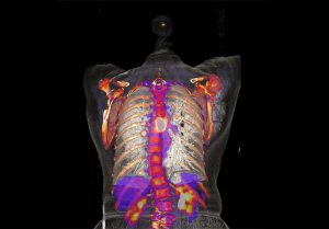 Euro-BioImaging will also provide open access to state-of-the-art biolmedical imaging techniques like the CT scan which generated this image of a human torso.

Image credits: University Medical Centre Mannheim, Medical Faculty Mannheim.