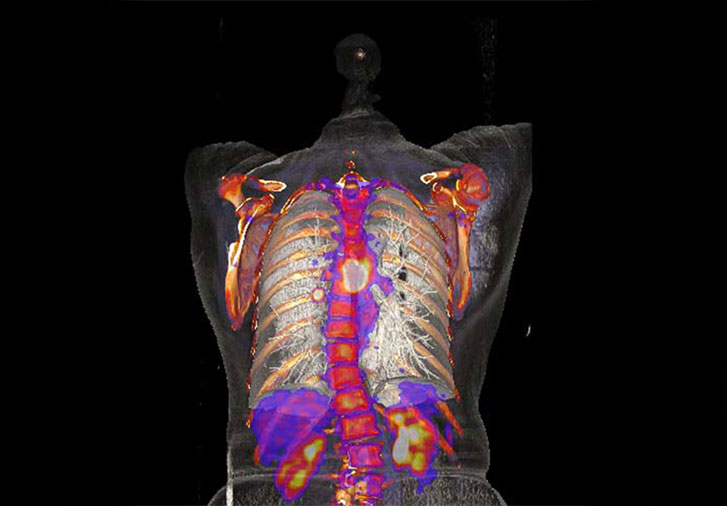 Euro-BioImaging will also provide open access to state-of-the-art biolmedical imaging techniques like the CT scan which generated this image of a human torso. Image credits: University Medical Centre Mannheim, Medical Faculty Mannheim.
