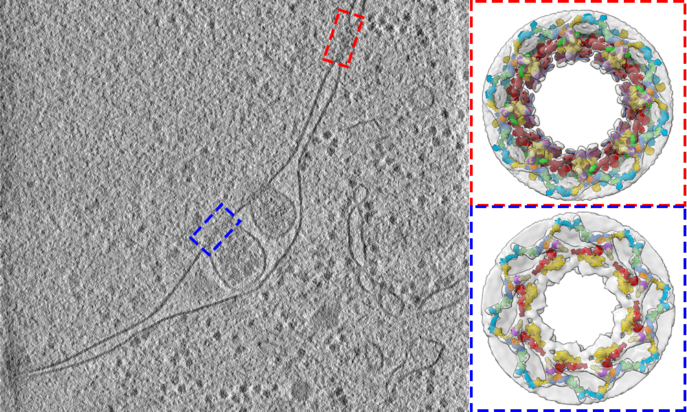 Left: Slice of a cell in grey. Right: Two 3D reconstructions of parts of the slice, showing the internal structure.