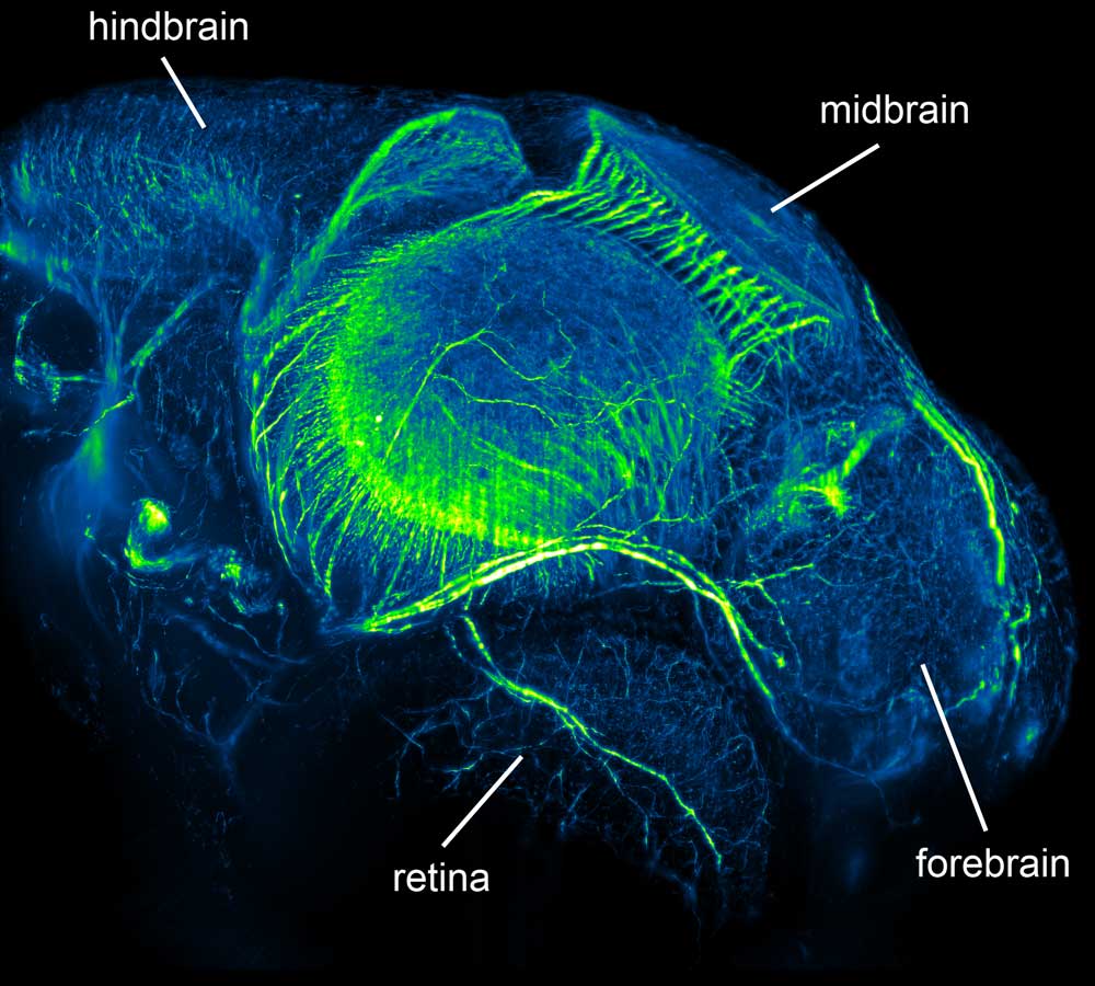A head close-up shot of Medaka juveniles taken by Philipp Keller, from the lab of Ernst Stelzer at the European Molecular Biology Laboratory (EMBL), with a newly developed microscope called Digital Scanned Laser Light Sheet Fluorescence Microscope. Picture credits: Philipp Keller, Stelzer Group, EMBL