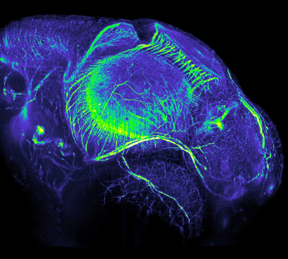 A head close-up shot of Medaka juveniles taken by Philipp Keller, from the lab of Ernst Stelzer at the European Molecular Biology Laboratory (EMBL), with a newly developed microscope called Digital Scanned Laser Light Sheet Fluorescence Microscope. Picture credits: Philipp Keller, Stelzer Group, EMBL