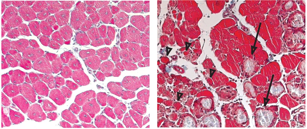 This microscopy image, taken ten days after injury, shows that the muscle fibres of normal mice (left) had re-grown, while in mice which couldn’t boost C/EBPβ production (right) there were still many fibres that had not regenerated (arrowheads), and the tissue had a number of scars (arrows).