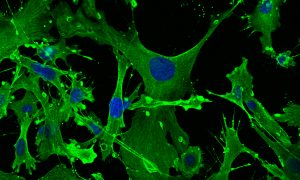 Mouse embryonic fibroblasts and their cell skeletons