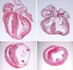 These microscopy images demonstrate the effects of Notch signalling on the hearts of newborn mice (top) and of adult mice after a heart attack (bottom). In a normal neonatal heart (top left), the two major heart chambers (ventricles) are clearly separated by tissue (septum). But when Notch signalling was inactivated in an embryo’s heart muscle cells, the septum between the ventricles of the newborn mouse’s heart was incomplete (asterisk). The same defect commonly occurs in humans with congenital heart disease, often leading to circulatory distress. In the images of adult hearts (bottom), healthy tissue is shown in red and damaged tissue in blue. Normally (bottom left), a heart attack causes extensive tissue damage to the left ventricle (right-hand cavity), but mice in which Notch was re-activated after the heart attack had reduced tissue damage (bottom right) and improved cardiac function. Image credit: EMBL
