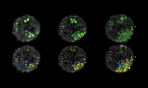 Top row: The evolution of tumour cells (green) within a normal organoid (grey) shown in three panels. Lower row: Surface rendition of tumour cells and labels new cells that arise from a single cell in the same colour.