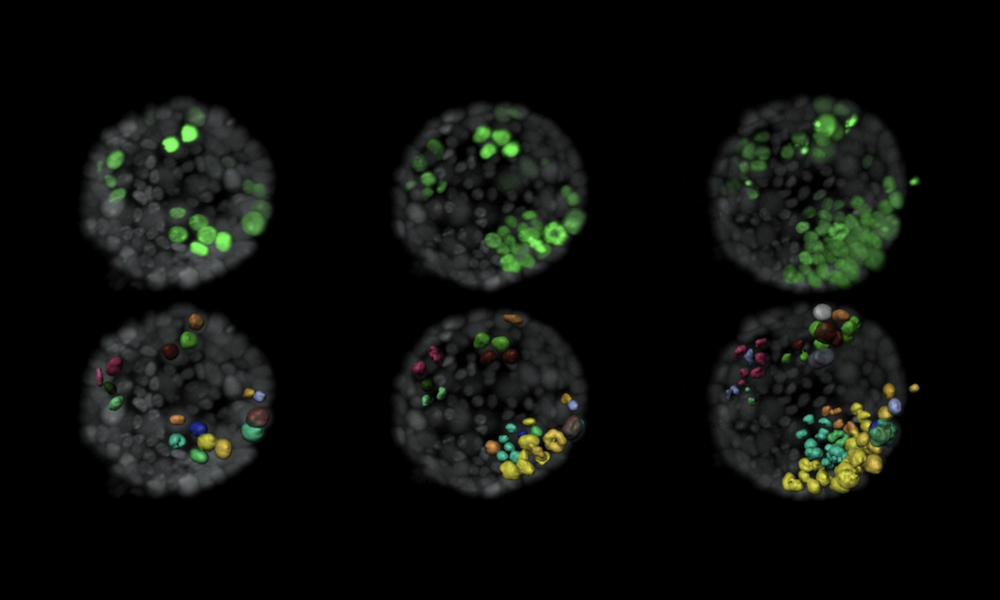 Top row: The evolution of tumour cells (green) within a normal organoid (grey) shown in three panels. Lower row: Surface rendition of tumour cells and labels new cells that arise from a single cell in the same colour.