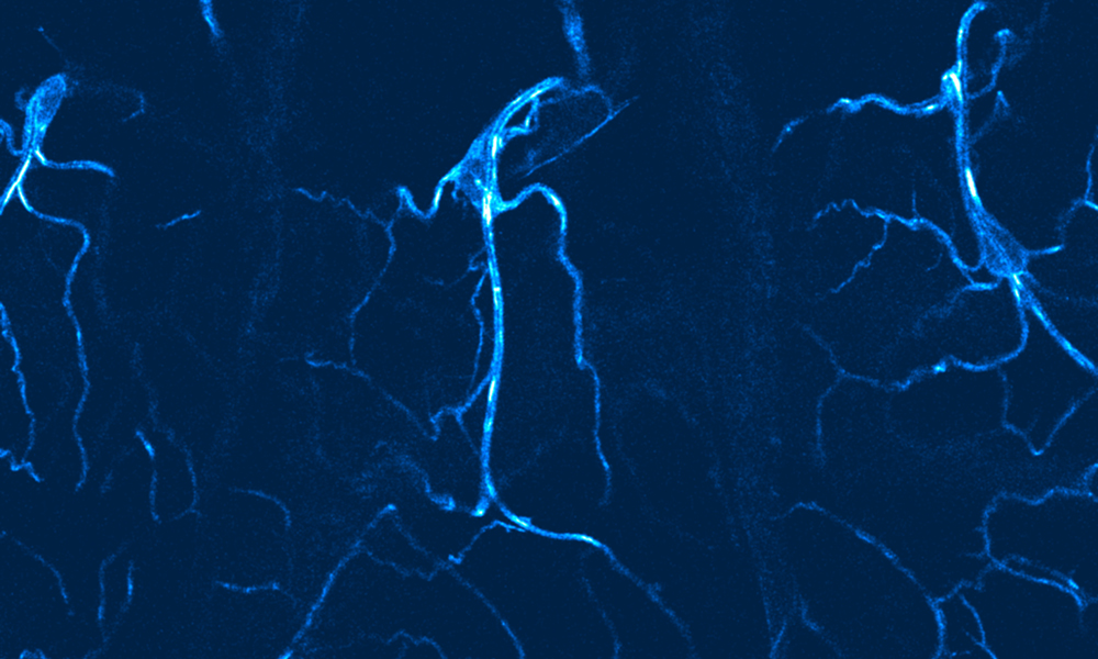 Fruit fly larval cells looking like blue lightning