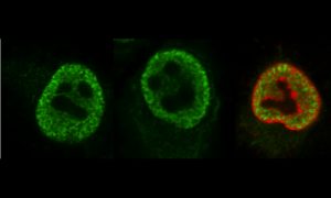 Three cells, each looking like a face.