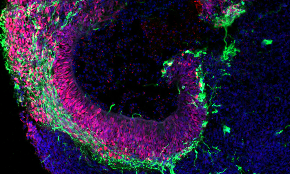 This image shows sections of the brain organoids that have been derived from pluripotent stem cells. The increasing use of organoids like this one be key to advancing personalised medicine.