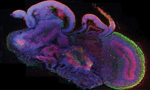 Microscopy image of cerebral organoid cross section