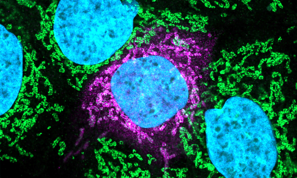 Four blue circular objects are surrounded with green structures, and the central blue circle with pink structures. The blue circles are human cell nuclei, and pink and green structures are proteins.