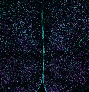 Lower part of a mouse brain slice has been processed to render visible all the locations of 10 different RNA species (purple dots). In cyan are observed single cell nuclei. 