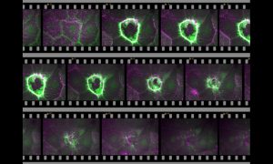 A filmstrip showing the healing process of a wound on cellular level.