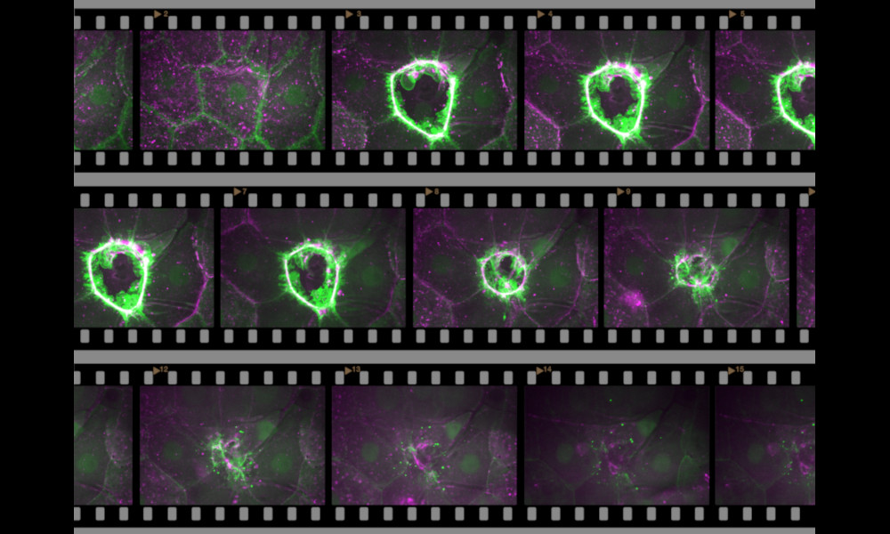 A filmstrip showing the healing process of a wound on cellular level.