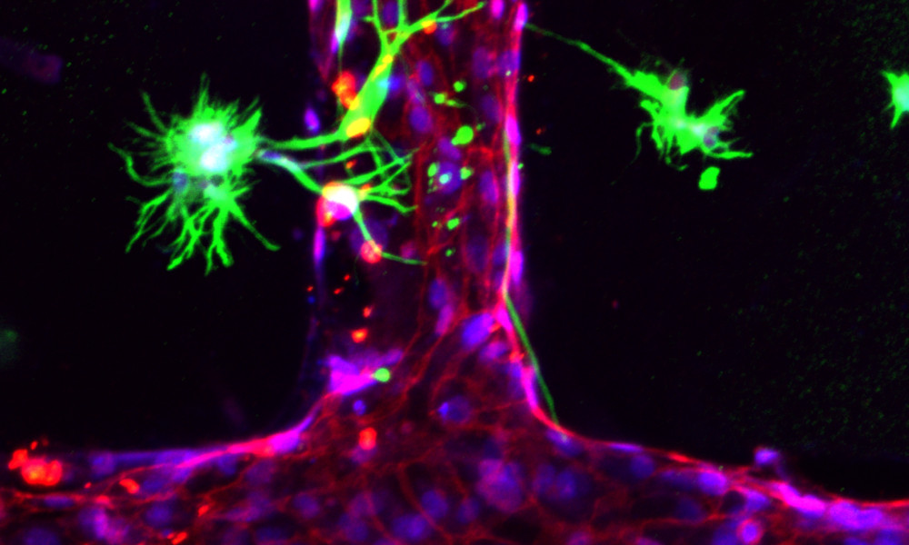 Green coloured brain cells next to a microfluidic network.