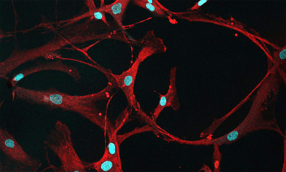 Red loops on a black background are dotted with bright red flecks and pale blue ovals as part of a confocal microscope image of bone marrow cells.