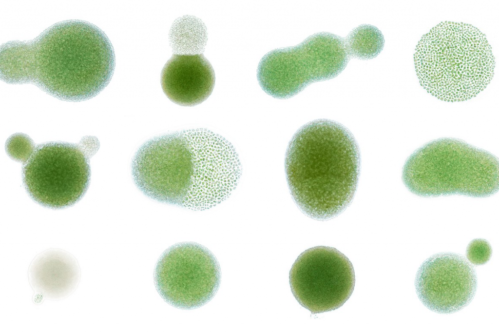 Green algae colonies from an agar plate. 