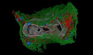 3D rendering of a human cell, attacked by a virus.