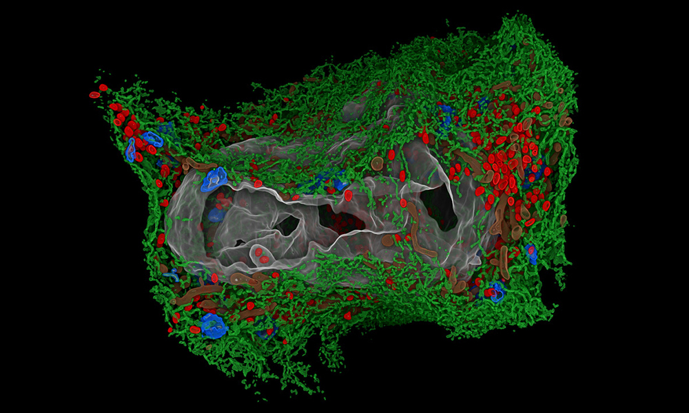 3D rendering of a human cell, attacked by a virus.