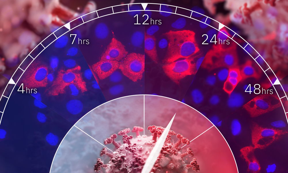 Microscopy images of coronavirus-infected cells in blue and red, arranged on a clockface. Illustrations of virus particles.