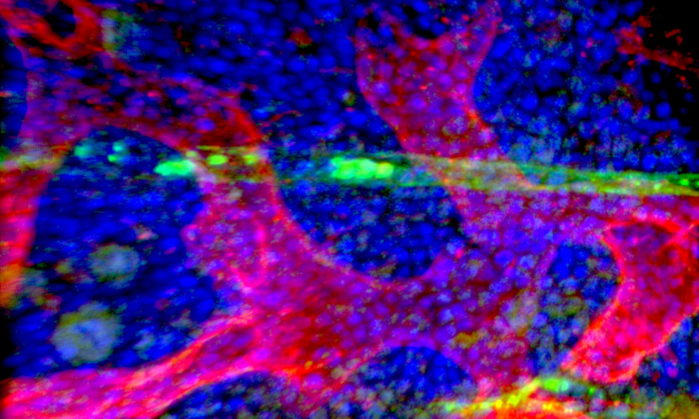 Microscopy image of stem cells in bone marrow