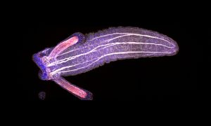 Sea anemone polyp seen through a microscope, cell nuclei and muscles highlighted.