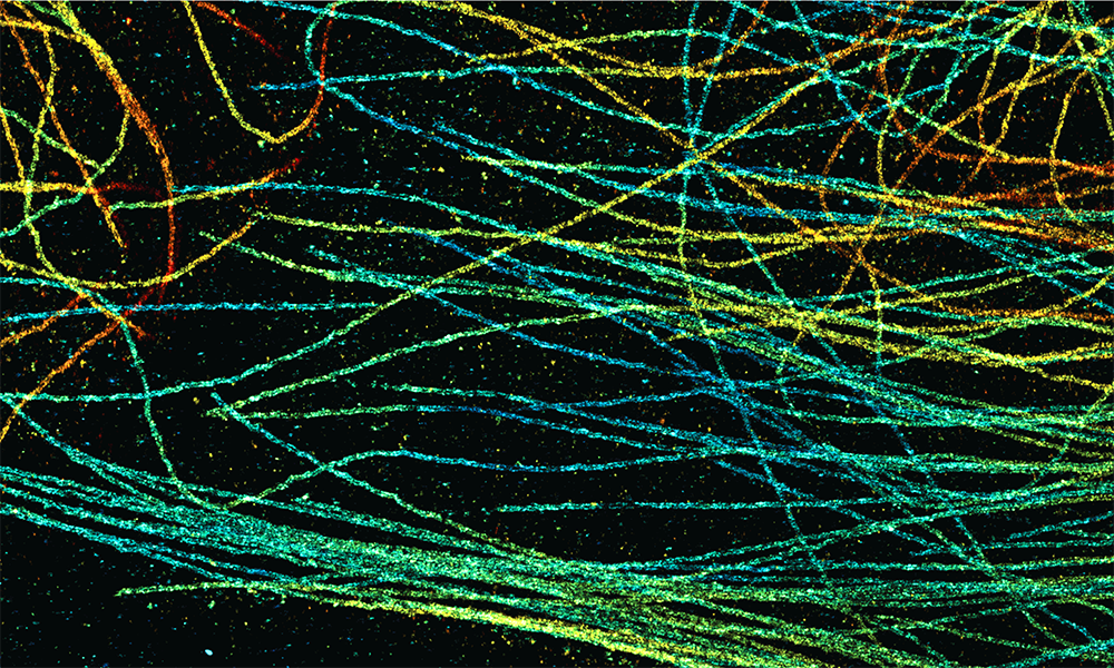 Labelled microtubules show as bright coloured lines on a black background