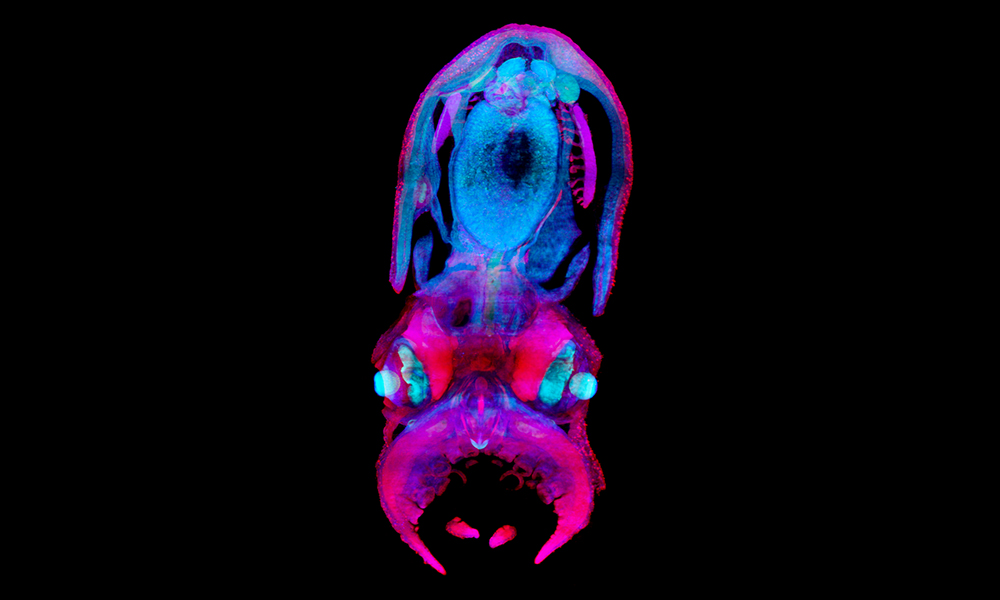 Pink and blue dominate a blurry image against a black background that is actually a global image of a 30-day-old Octopus vulgaris