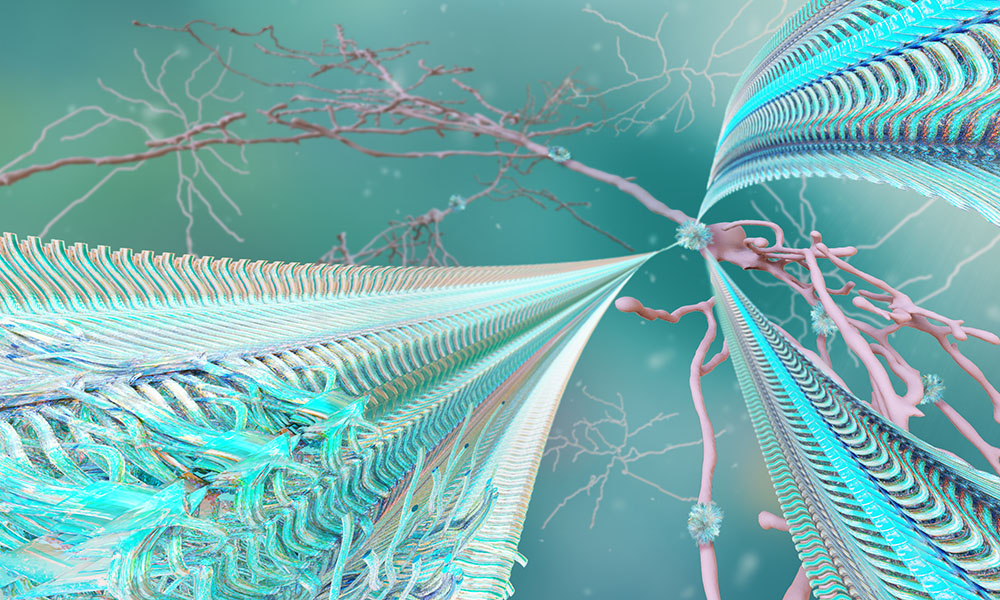 Three amyloid fibres built of repetitive smaller elements are coming out of a neuronal cell. The strong perspective of the fibres gives a dramatic feel to the illustration. 