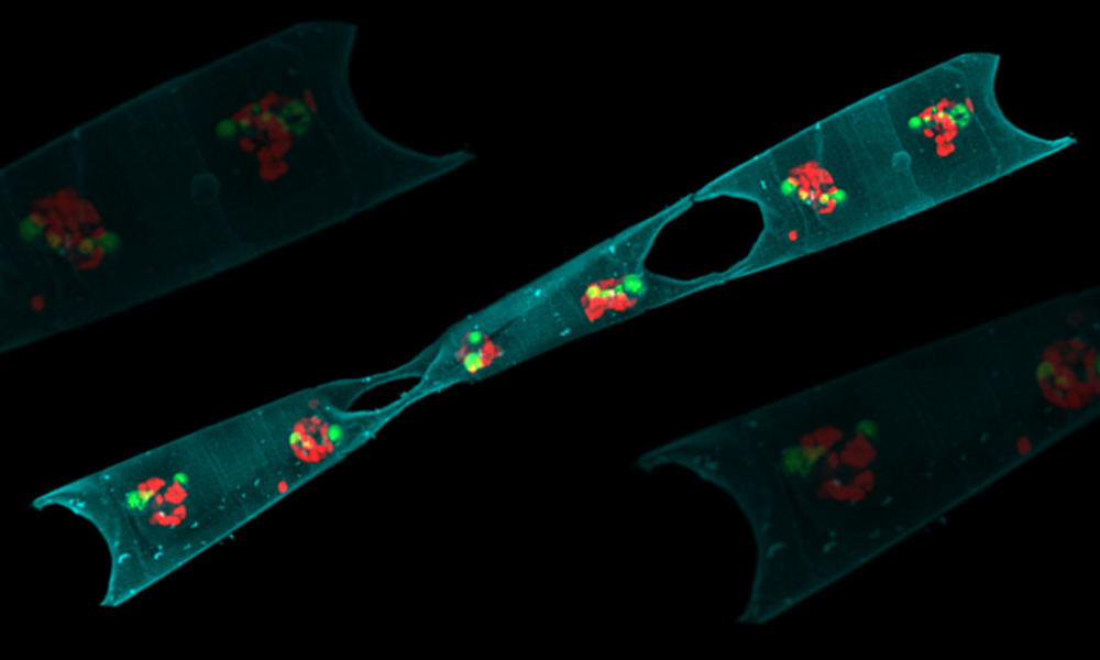 Oblong shape with two holes and coloured dots inside, representing phytoplankton cells and nitrogen-fixing bacteria