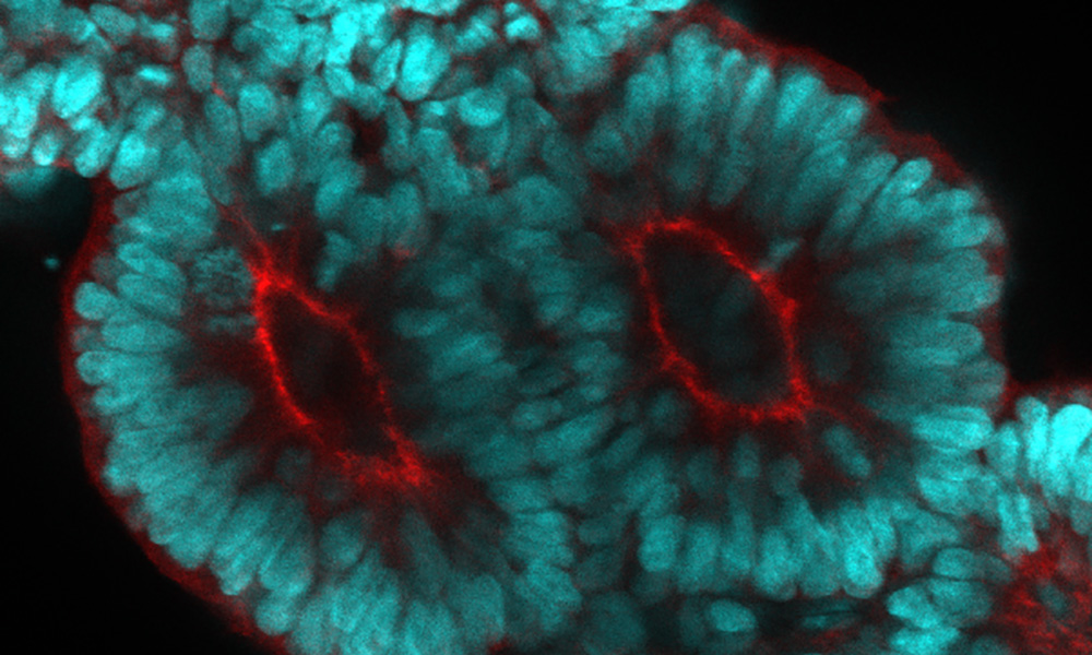 Microsocopy image of Pair of somites. Blue is a nuclear marker (DAPI) and red is an apical marker (ZO-1).