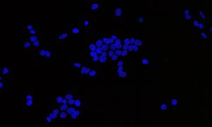 Microscopy image showing mouse cells in blue on a dark background. The mouse cells look like little blue blobs.