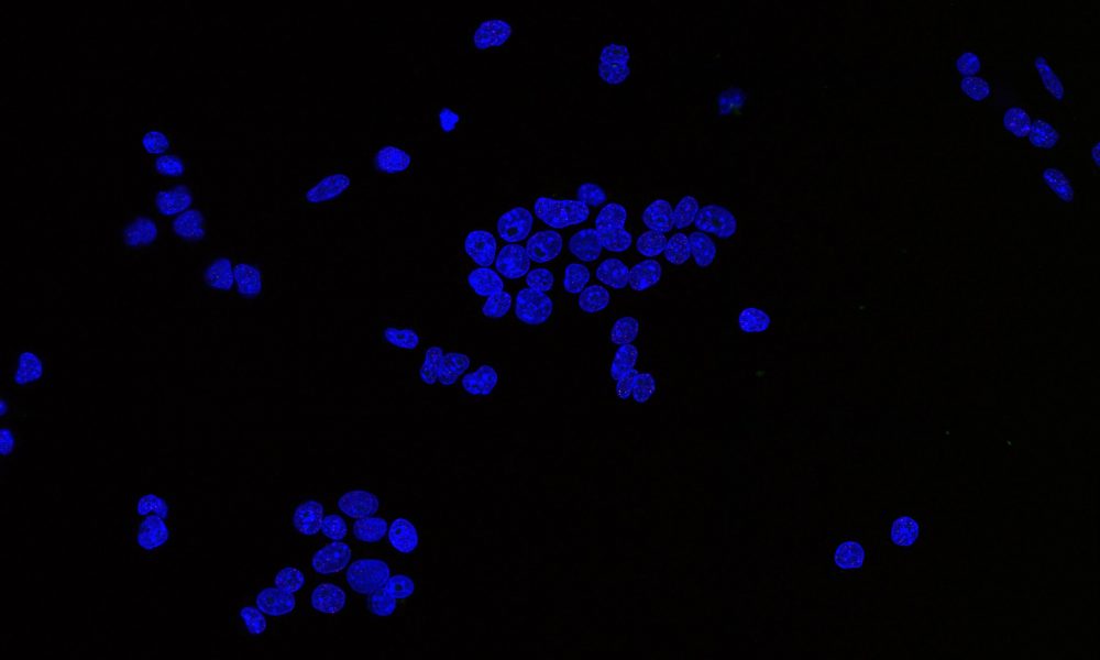 Microscopy image showing mouse cells in blue on a dark background. The mouse cells look like little blue blobs.