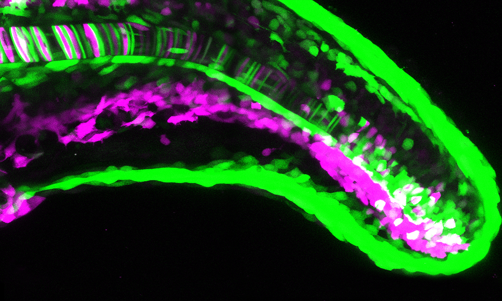 A rod-like structure with green and magenta segments representing cellular markers.