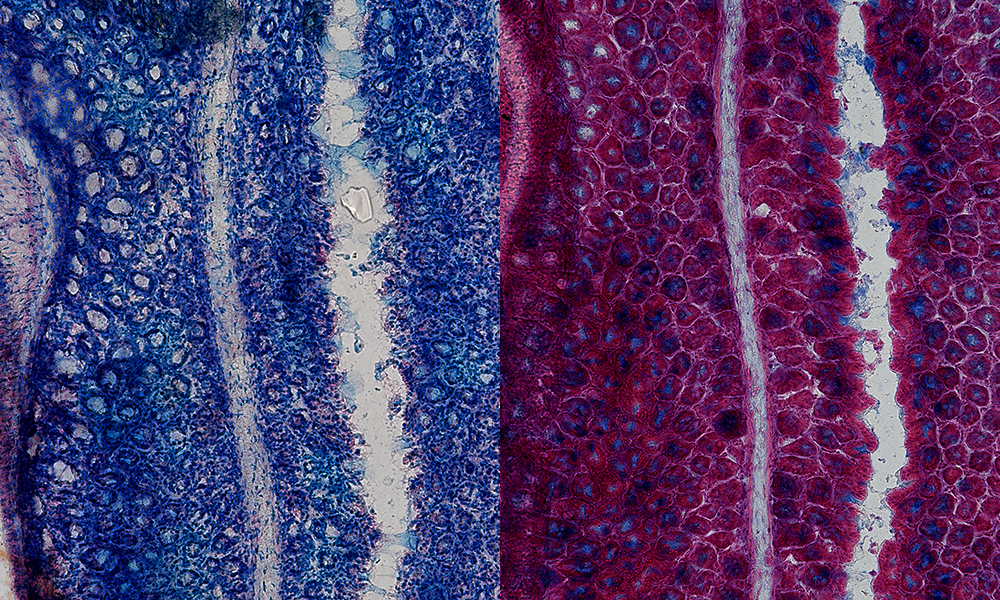 Cross sections of mouse colon, with mucus stained in blue and nuclei stained in red. The right section has been treated with a mucolytic agent.