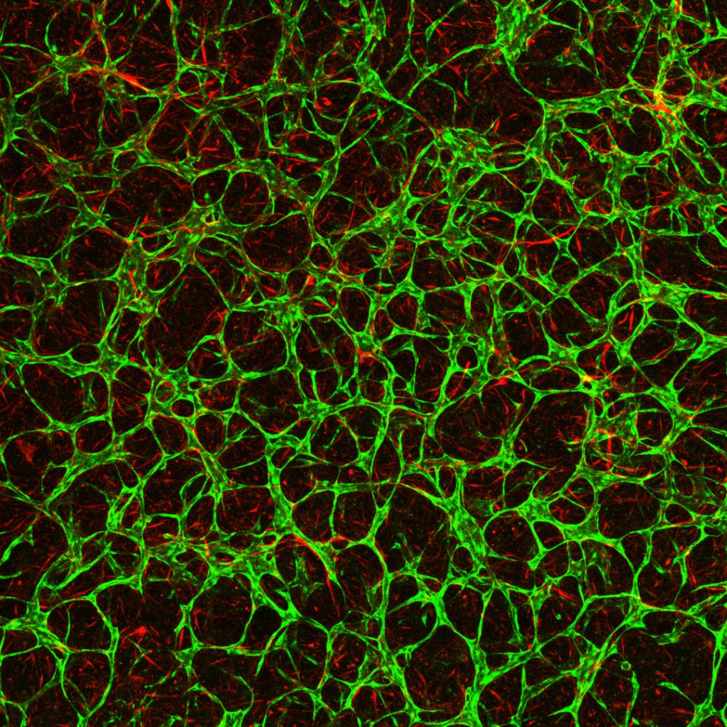 Microscope image showing artificial placental vessels, stained in green.