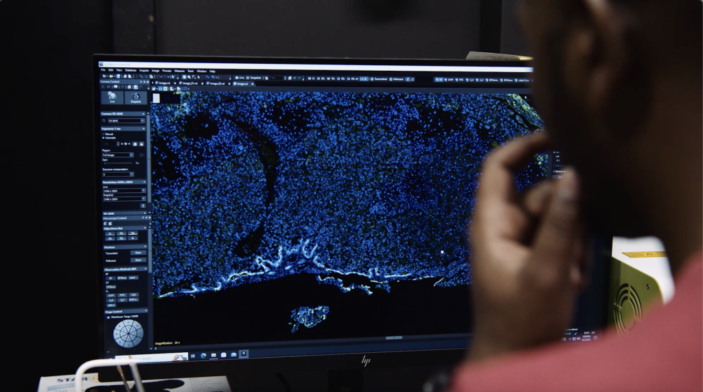 Person in front a computer screen showing placental tissue stained in blue.