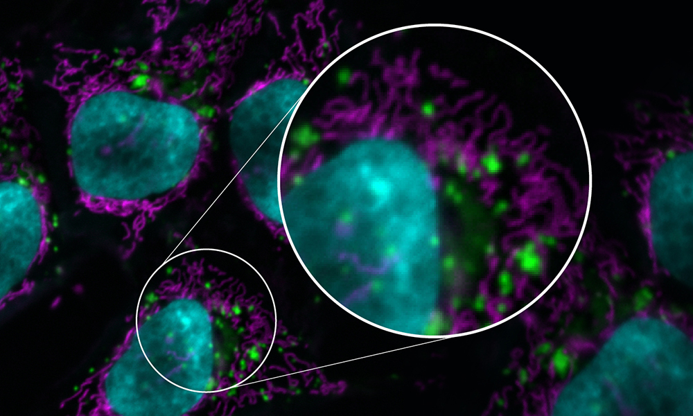 A representative image of a micrograph, with circles representing maginification