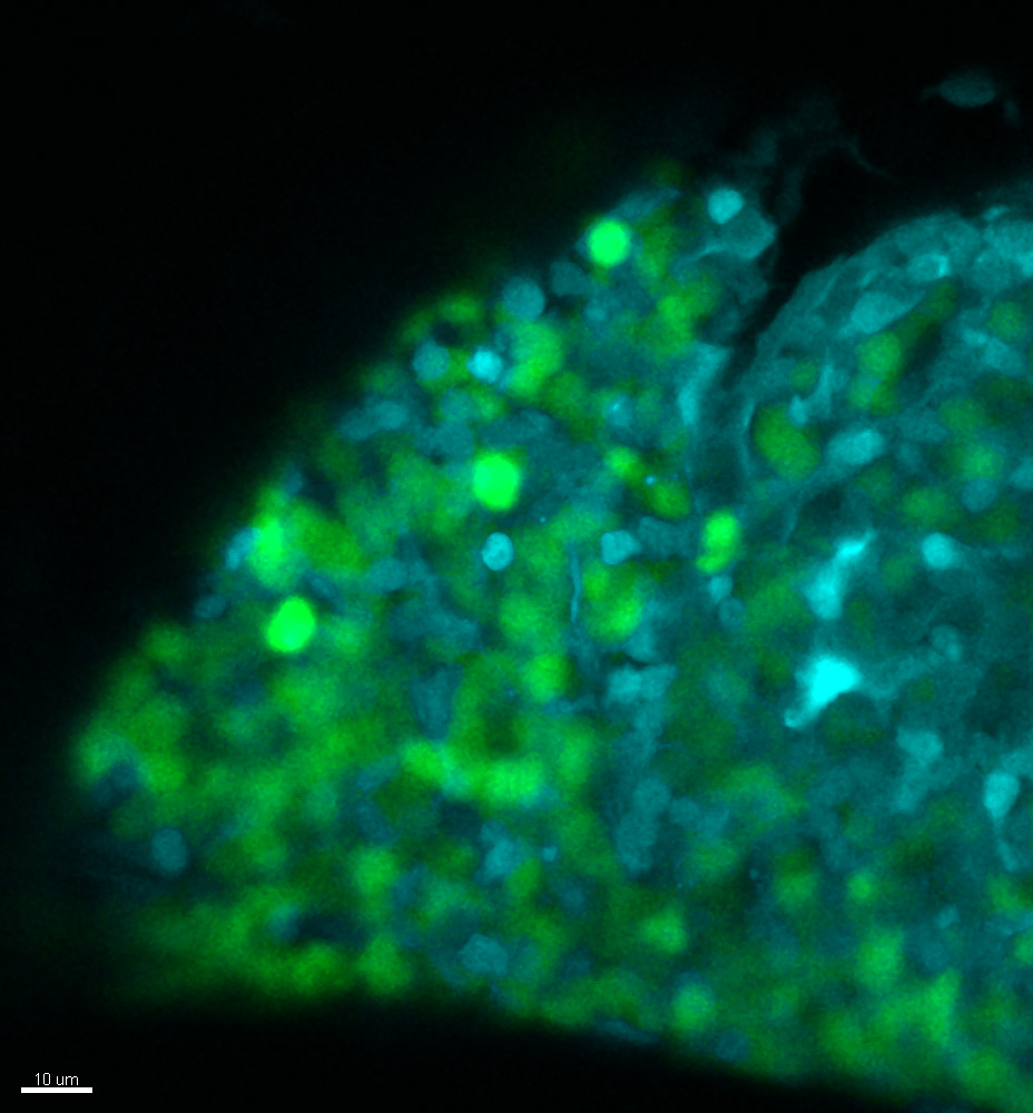 Microscopy image showing T-cell progenitor cells in green and thymic niche cells in blue.
