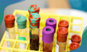 test tubes in rack