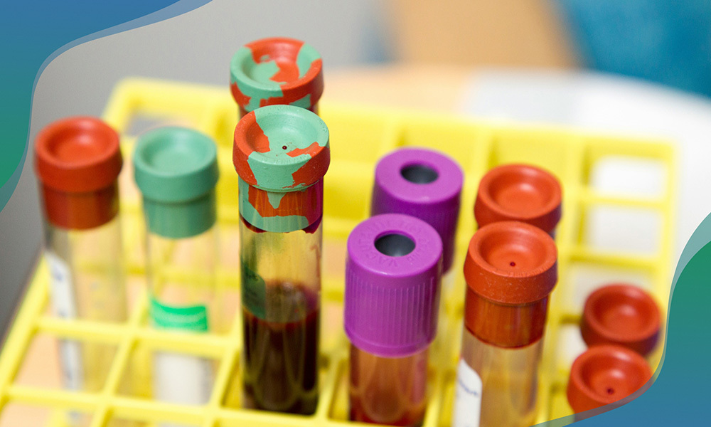 test tubes in rack