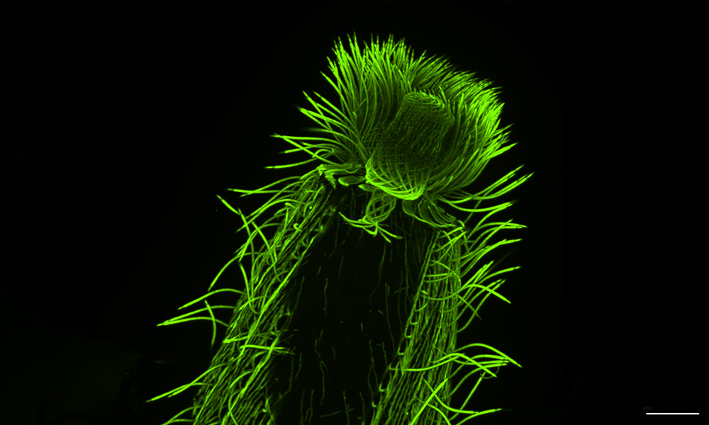 A cylindrical microorganism against a black background, with hairlike projections highlighted in green along its surface.