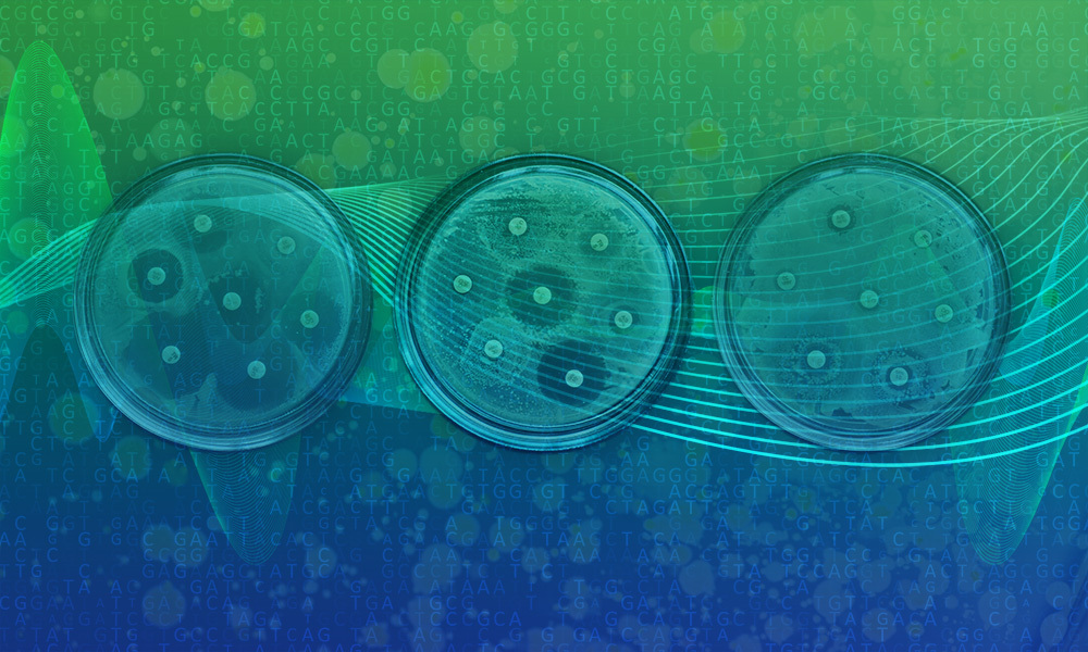 Bacteria growing on plates to show antibiotic resistance