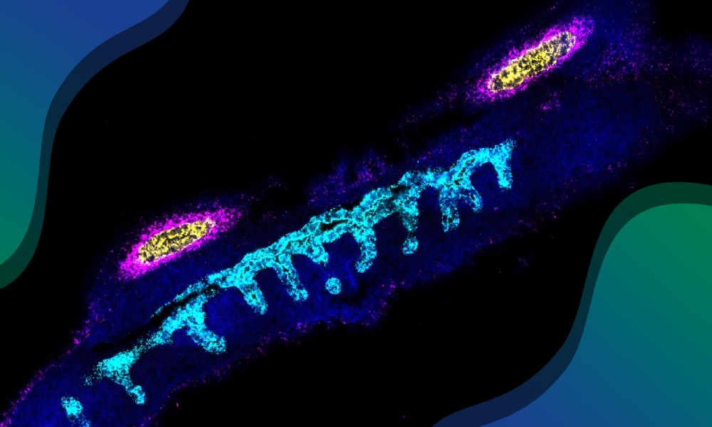 Microscopy image of developing human reproductive tract