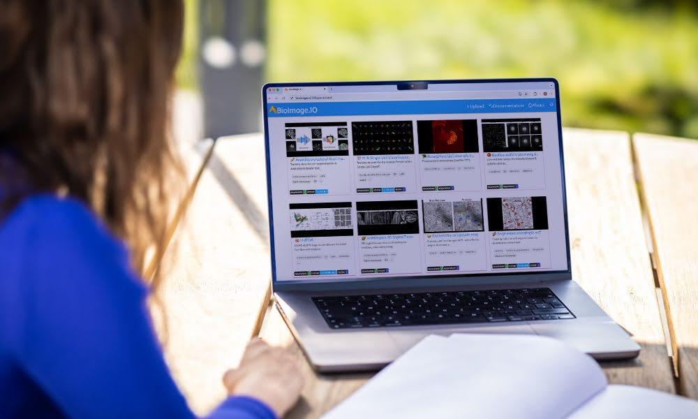 A woman looks at a laptop displaying the BioImage.io webpage.