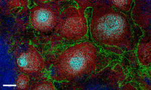 Microscopy image showing cells in reactive lymph nodes in four colours, as described in the caption.