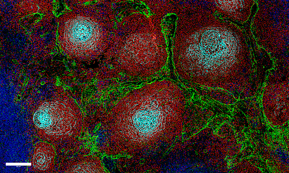 Microscopy image showing cells in reactive lymph nodes in four colours, as described in the caption.